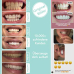 UniqueSmile Teeth Whitening Kit