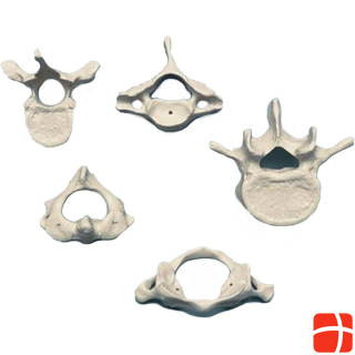 Rüdiger Skeleton cervical vertebra