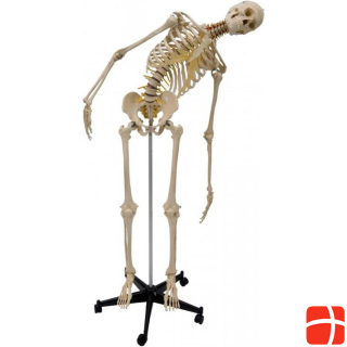 Скелет человека Рюдигера