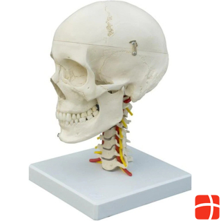 Скелетный череп Рюдигера на шейном отделе позвоночника