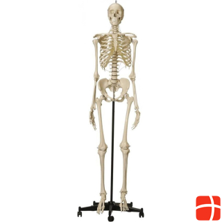 Rüdiger Skeleton with female pelvis