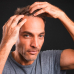 Hairvest HAIR LOSS FORTE Intensive Treatment