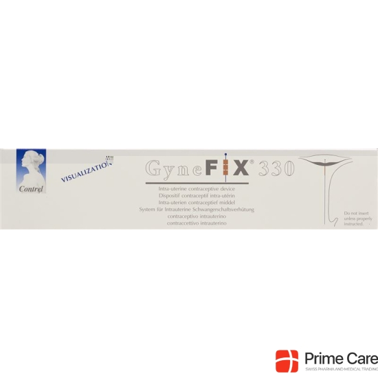 GyneFix 330 IUD