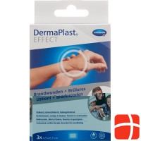 Dermaplast Burns Plasters 45x65mm Kl 3 Stück