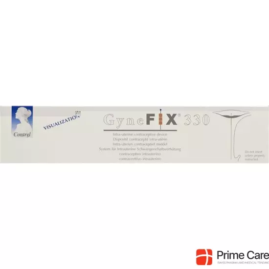 GyneFix 330 IUD